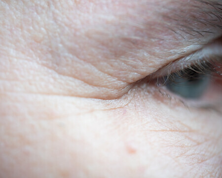 weer een rimpeltje erbij